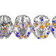 Image for article titled Scientists Succeed In Objectively Measuring Pain